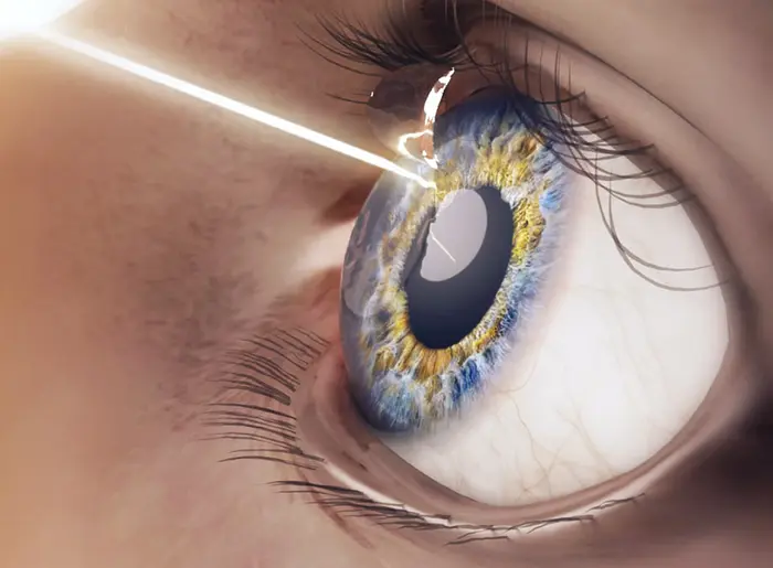 Augenlasern bei MUNICH EYE in München